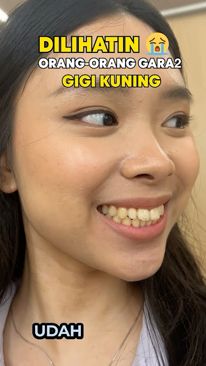 Gigi Kuning Bikin Senyum Gak Pede #smileexpert #pemutihgigi