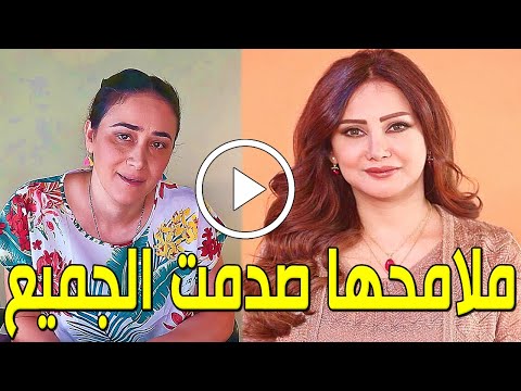 تحولت إلي هيكل عظمي ظهور مفزع للفنانة الكويتية يلدا لن تصدق كيف أصبحت ملامحها بعمر الخمسين ستصدمكم