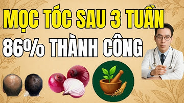 Bí Mật- Nước Ép Hành Tây Trị Rụng Tóc 86%-Hiệu Quả Dùng Sau 6 Tuần!