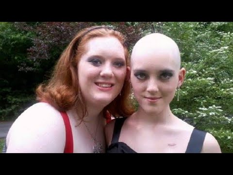 Her Twin Sister’s Life Was Taken by Leukemia, So She Shared These Heartbreaking Pictures Online