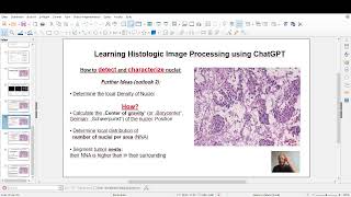 Histologic Image Processing Using ChatGPT and Python (Part 3) Wealth