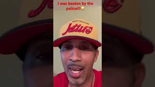 Mac Phipps: “I was beaten by the police!”