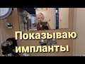 Показываю импланты