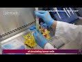 ScreenCell tracks circulating tumor cells (VF ST ENG)