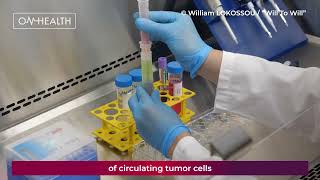 ScreenCell tracks circulating tumor cells (VF ST ENG)
