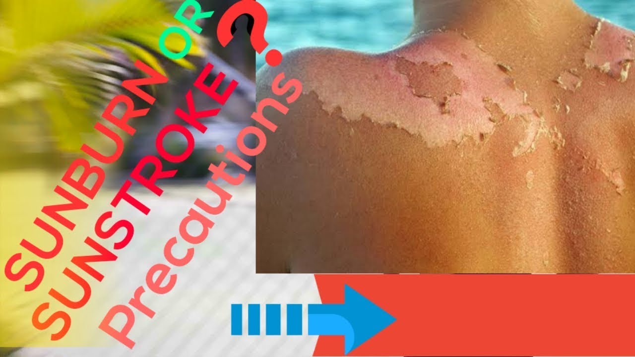 Sunstroke and sunburn precautions camera iphone 8 plus apk