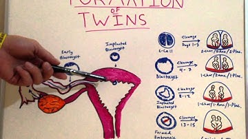 Formation of Twins - Embryology Video for Medical Students - USMLE Step 1