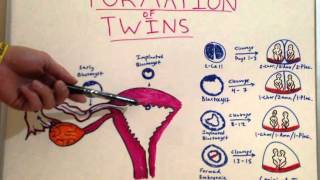 Formation of Twins - Embryology Video for Medical Students - USMLE Step 1