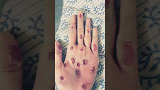#fakewoundtutorial #makeupartist #beginnerfriendly #stepbystepmakeup #likesubscribecomment