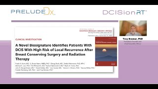 Identifying DCIS Patients Still at Elevated Risk of Recurrence after Surgery and Radiation