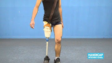 Video 4 - Dynamic aligment of Transfemoral Interim Prosthesis