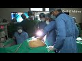 Laparoscopic Repair of Para Umbilical Hernia Fully Explained