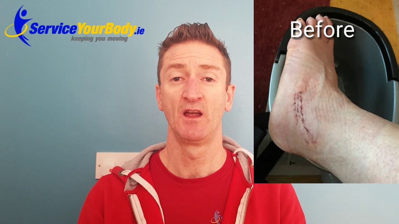 A case of Scar Sensitivity - YouTube