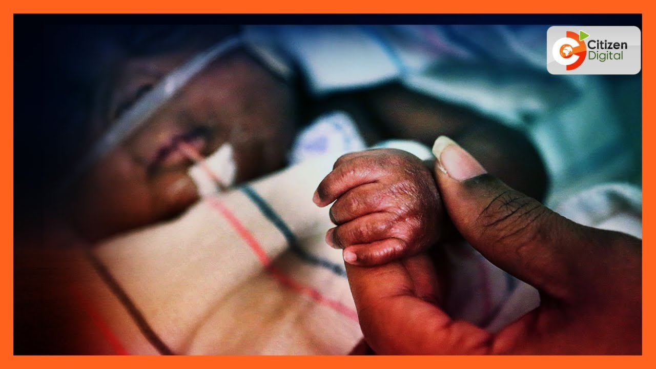 Siha na Maumbile | Matatizo ya homa ya manjano kwa watoto wachanga