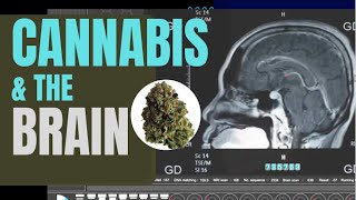 Marijuana and The Brain: Learn the Different Effects Sativa and Indica Strains have on the Brain
