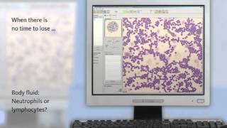 Sysmex - Optimisation of the quality of the results and the turn-around times in the laboratory