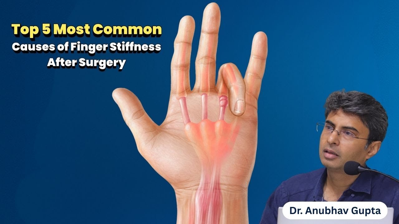 Top 5 Causes of Finger Stiffness After Surgery | Hand Surgeon Explains