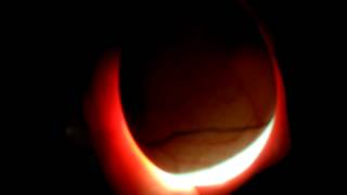 Candling Eggs Day 17