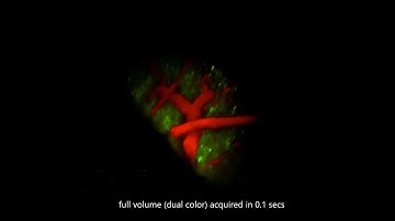 High speed volumetric light sheet imaging of awake behaving mouse brain