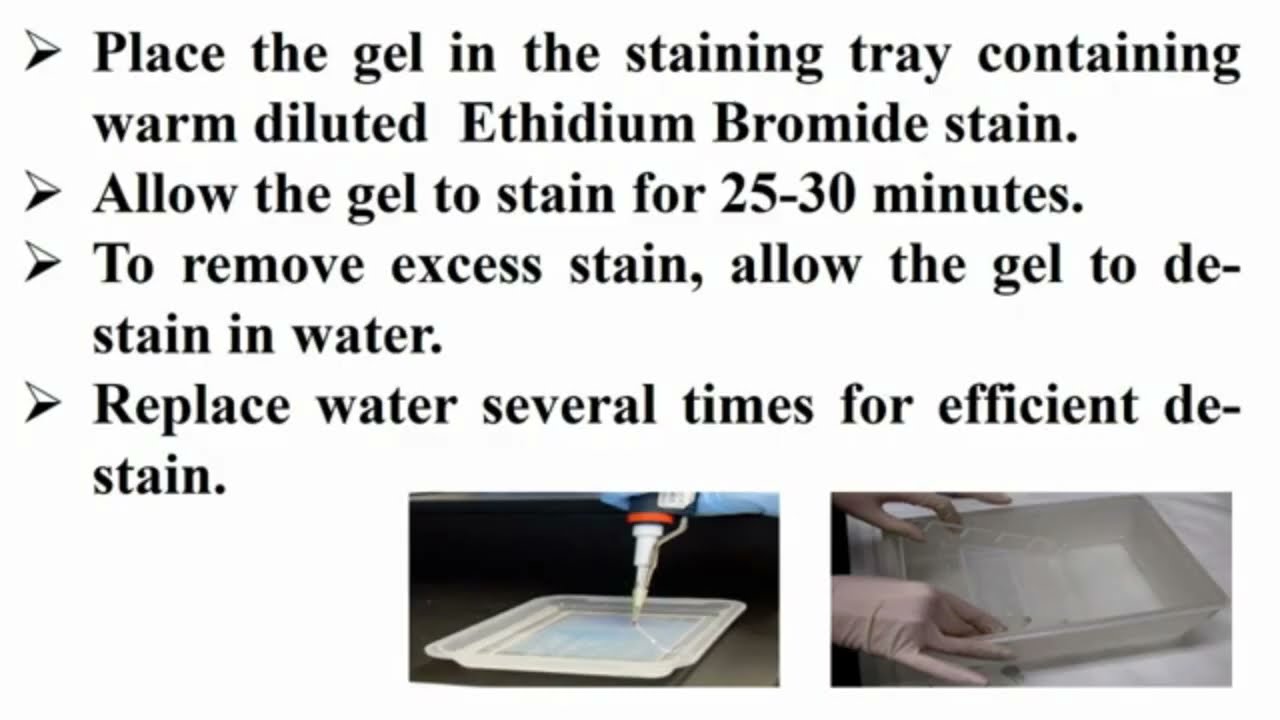 Staining Agarose Gel with Ethidium Bromide After Finishing Electrophoresis Running