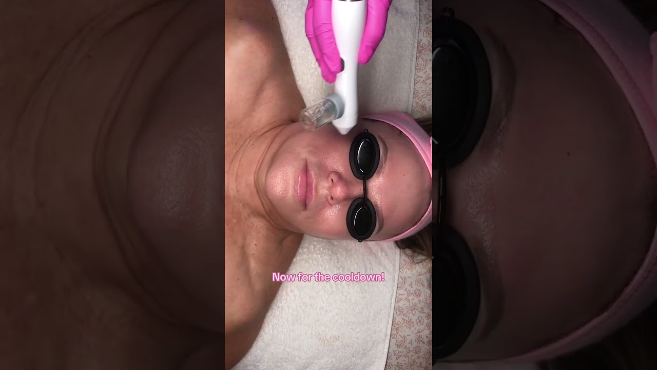 Oxygen Sprayer Facial: The Secret to Dewy, Hydrated Skin