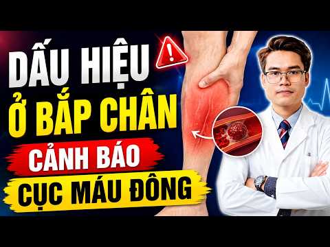 Dấu Hiệu Ở Bắp Chân Cảnh Báo Cục Máu Đông Mà Rất Nhiều Người Bỏ Qua | Bs Phạm Tuấn