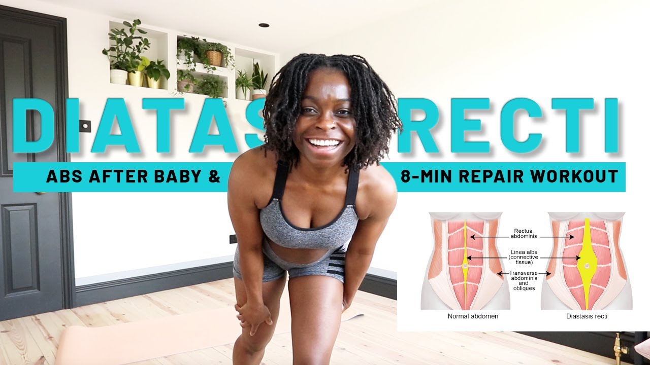 Postpartum Body | Get Rid of Mommy Tummy with 8 Simple Diastasis Recti Repair Exercises