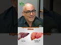A gordura do fígado #dayansiebra #gorduranofigado #esteatosehepatica #diabetes #hipertensao Mp3 Song