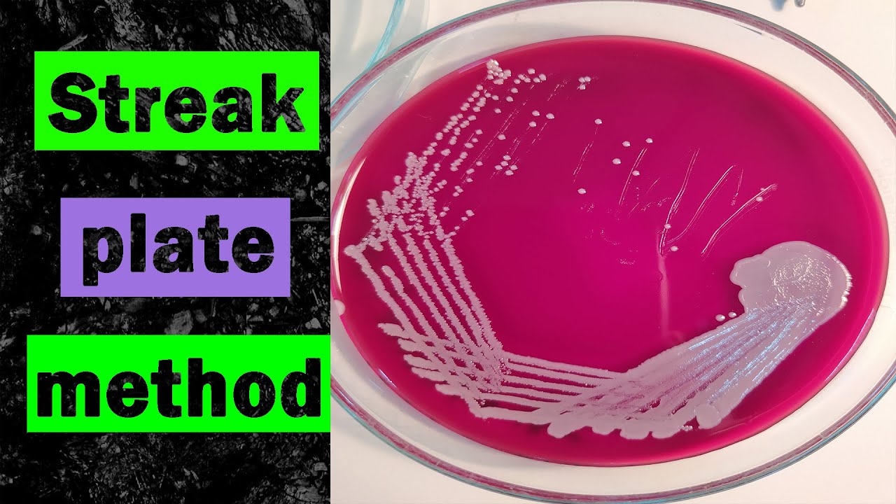 Streak plate method for isolation of bacteria | Procedure|Results|Microbiology