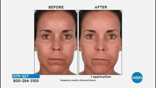 Skinn Cosmetics DermAppeal Microderm Beauty Treatment