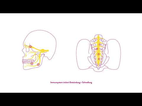 E-Learning Herpes Typ Eins und Herpes Typ Zwei Teil 1