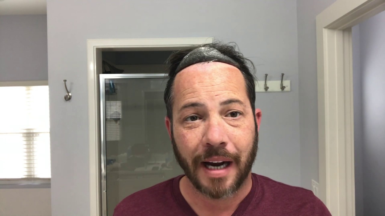 .03 Poly Hairline Redo в реальном времени, быстро и легко