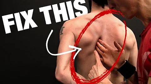 How to Fix Scapular Winging (STEP BY STEP!)