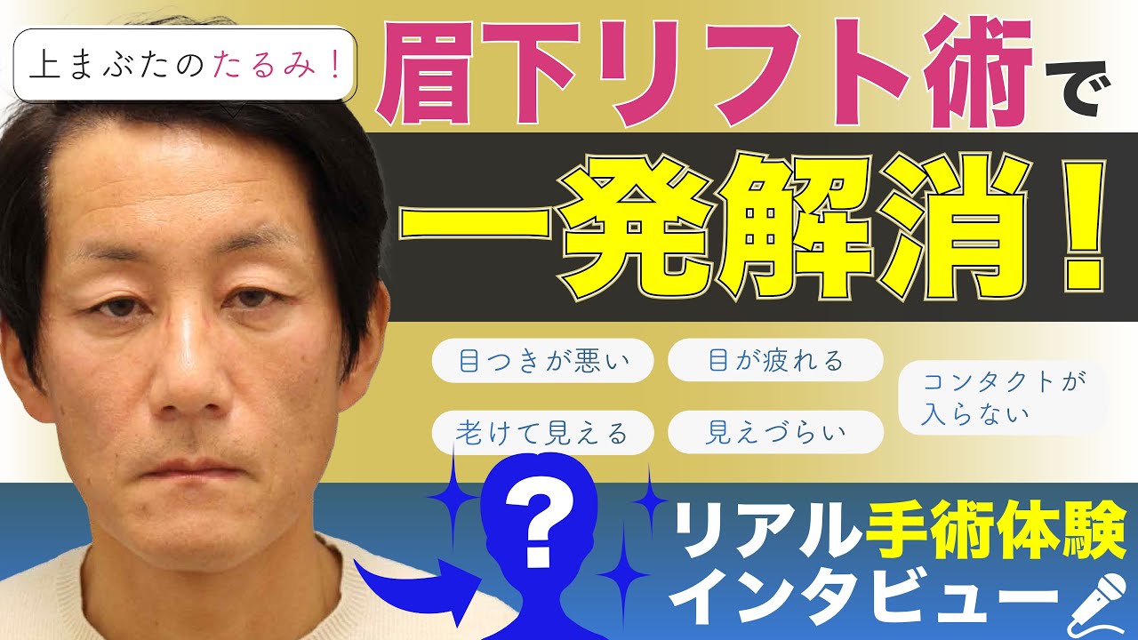 頭痛？肩こり？見えずらい？それ、上まぶたのたるみが原因かも YouTube