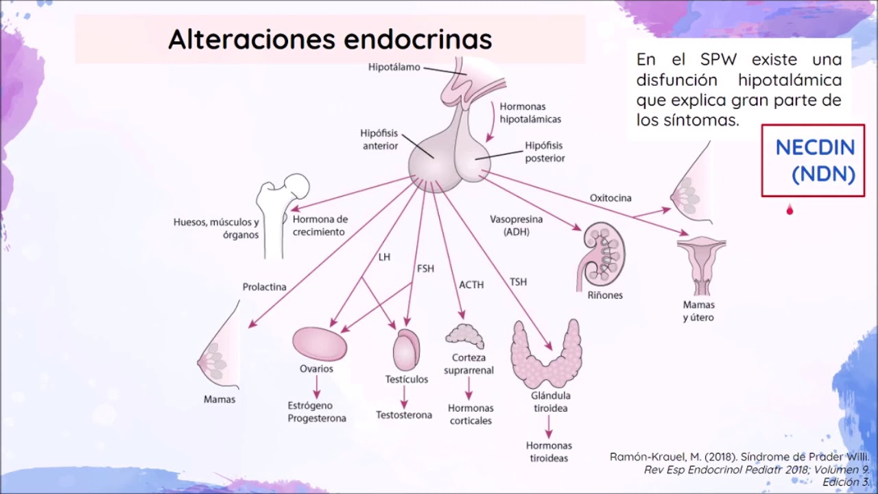 Prader Willi Angelman