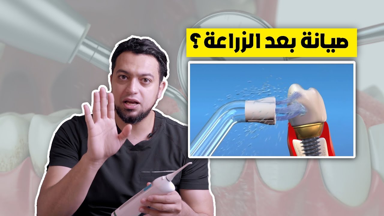 (٩)هل يوجد صيانة بعد الزراعة؟ ||  د. زراعة - الحلقة التاسعة