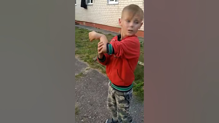 Мальчик сломал руку