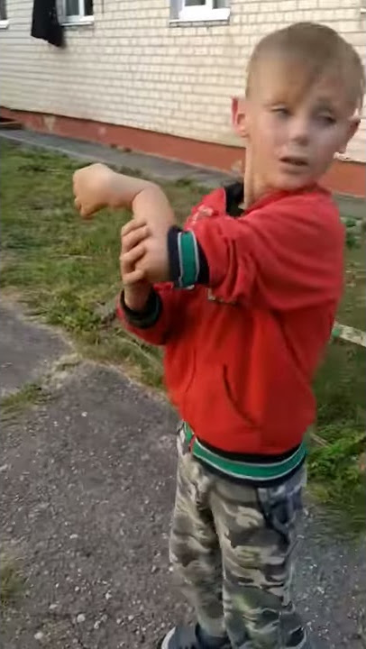 Мальчик сломал руку