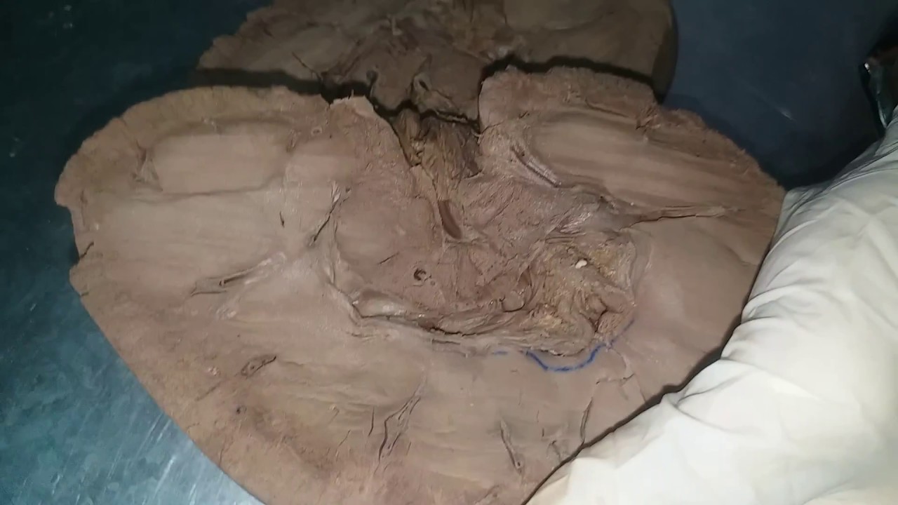 Anatomy of Equine (horse) kidney YouTube