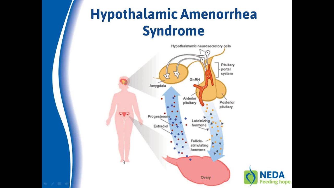 Eating Disorders, Body Image and Pregnancy