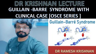 Guillain Barre Syndrome@GBS  (AIDP) Clinical Case OSCE series