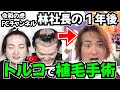 【お宝映像】令和の虎 林社長トルコ植毛の1年後に密着【自毛植毛|フランチャイズチャンネル】