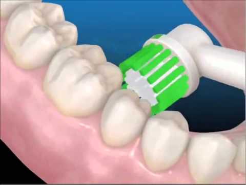 La correcta técnica de cepillado cepillo eléctrico YouTube