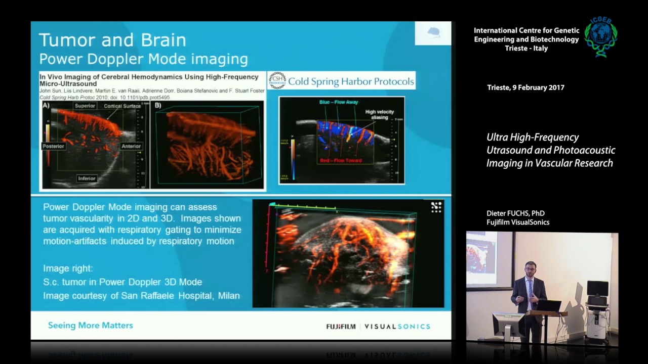 D. Fuchs - Ultra High-Frequency Ultrasound and Photoacoustic Imaging in Vascular Research