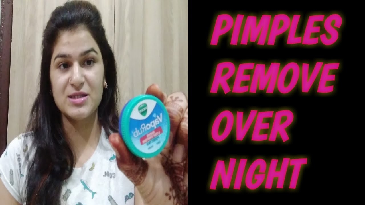 Vicks benefits for pimples? How to use Vicks for pimples skin!!