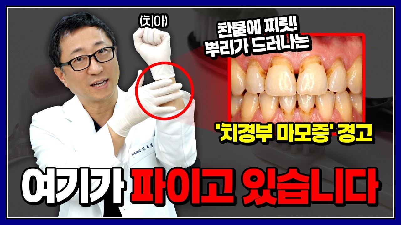 양치질 이렇게 하면 치아 다 패입니다