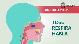 Introducción Ovace Pediátrico