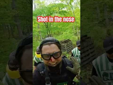 Took one to the nose… unlocked a third nostril #airsoft #airsoftfail #airsoftcanada