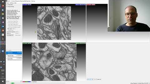 Lecture 8.5: Seeded Watershed Segmentation | ilastik Demo | CVF20