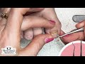 Toenail Progress for Beginners #nails #satisfying